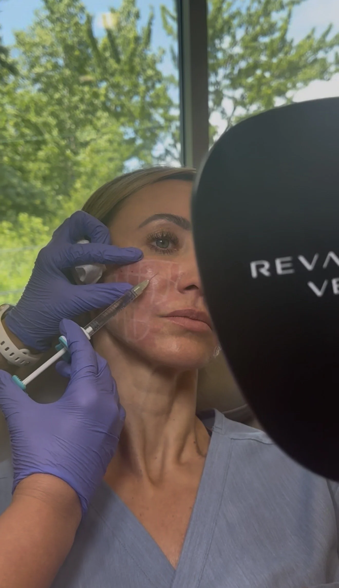 Skinvive