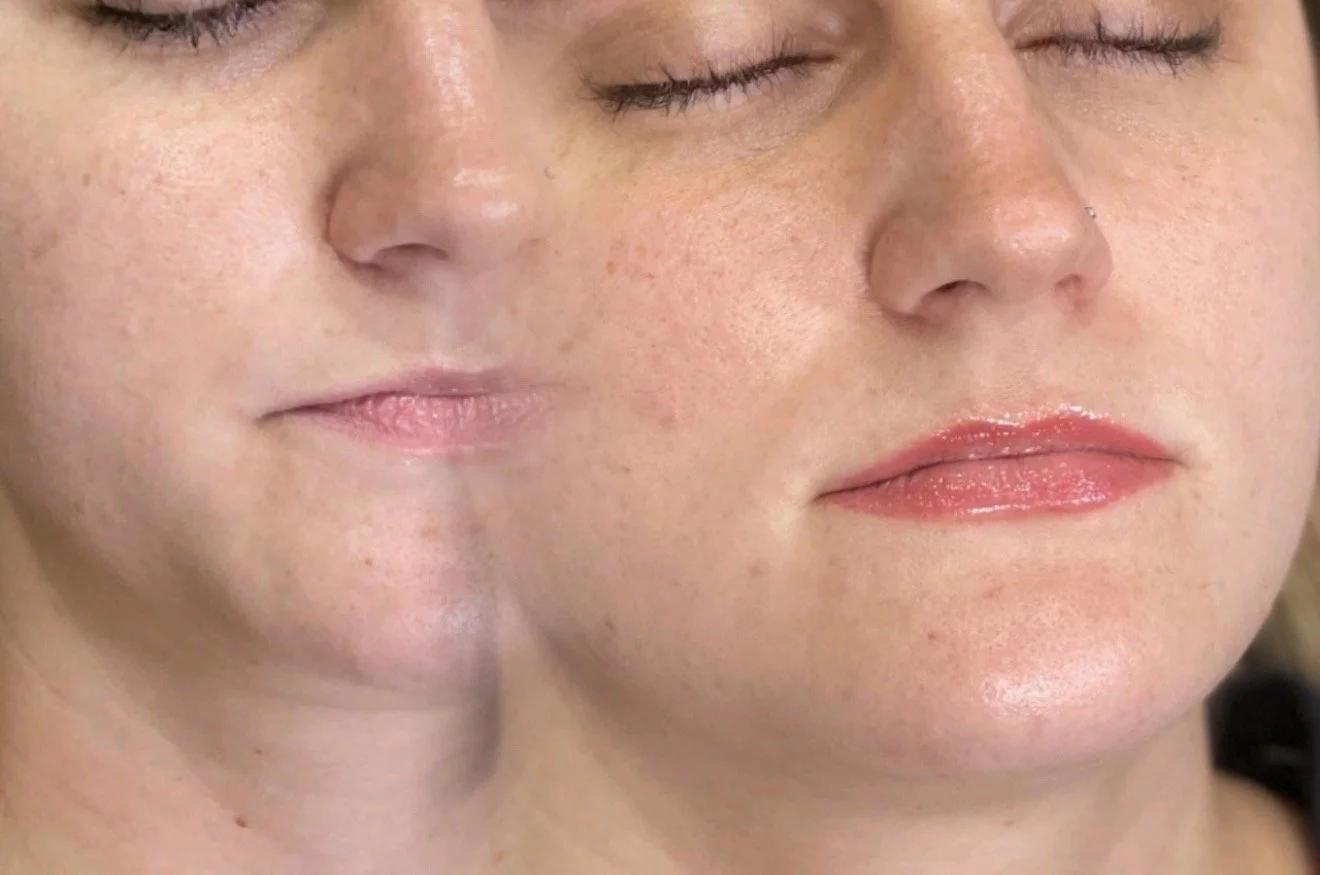 Lip Blushing in St.John, Indiana, at Beauty and the Med Spa.