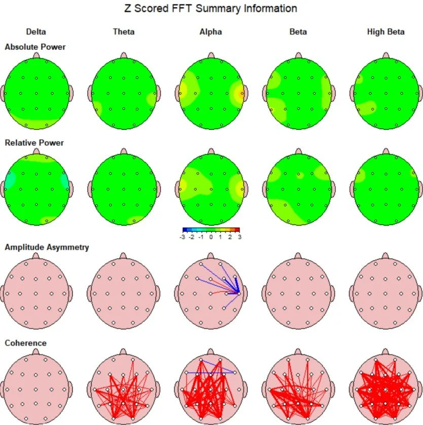 What is a QEEG Brain Map?