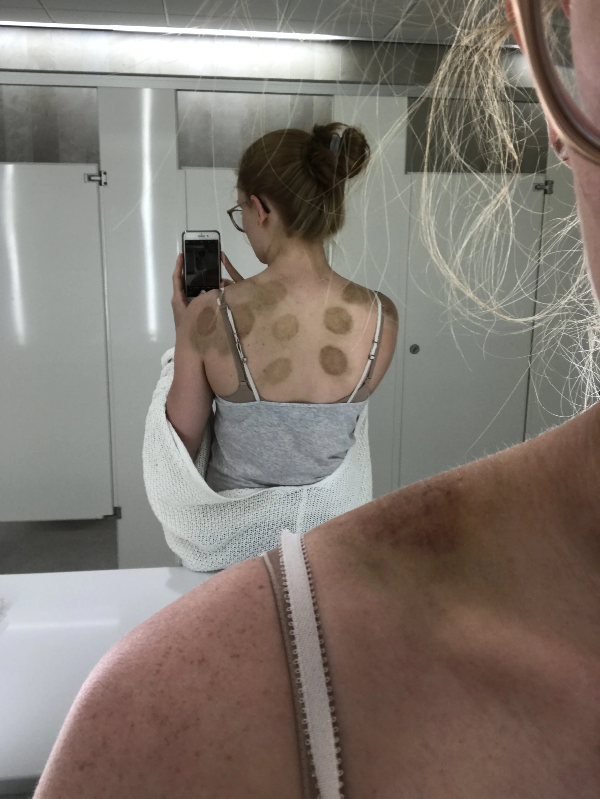 Pain/injury treatment during college - spent a lot of time looking like this