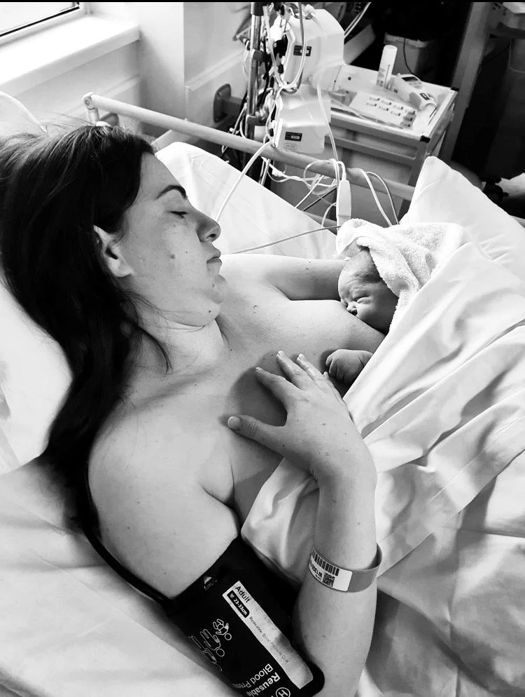 My gentle caesarean birth