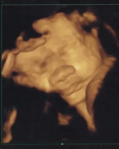 Hello Baby - Third Trimester 3D/4D