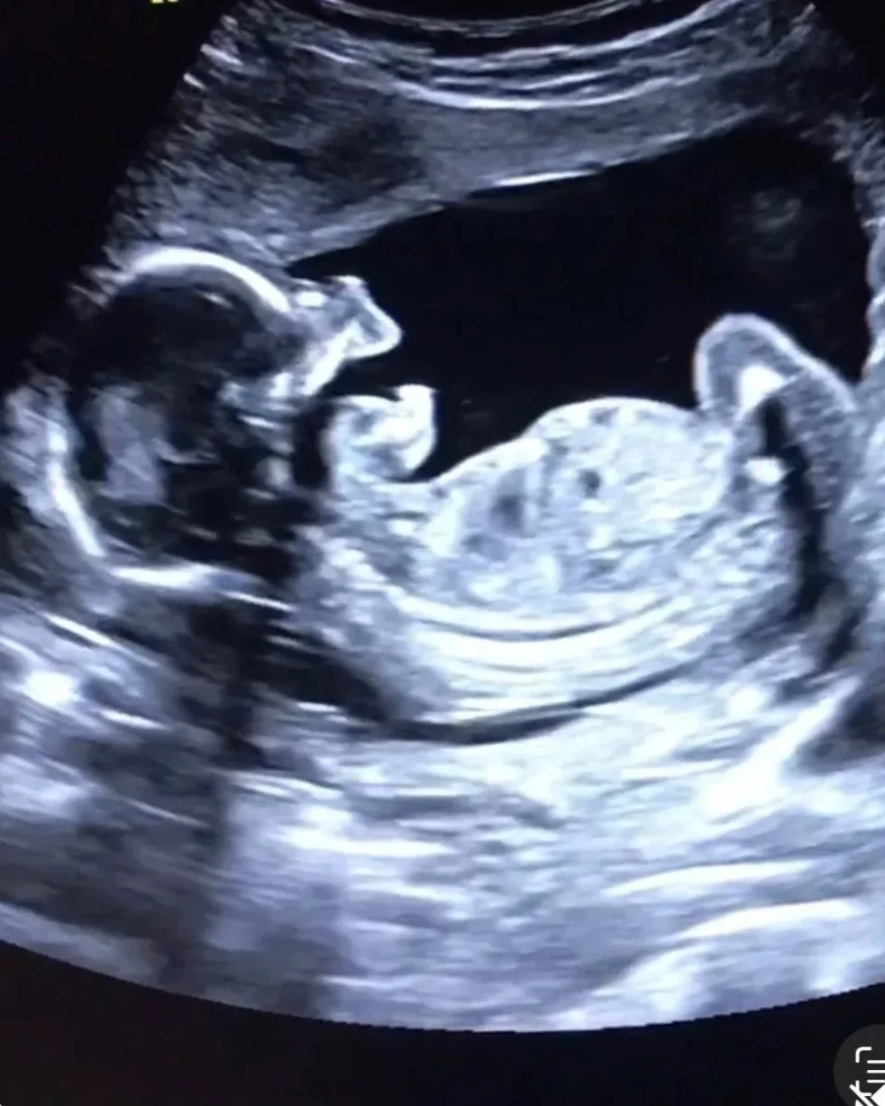 Hey Baby - Second Trimester