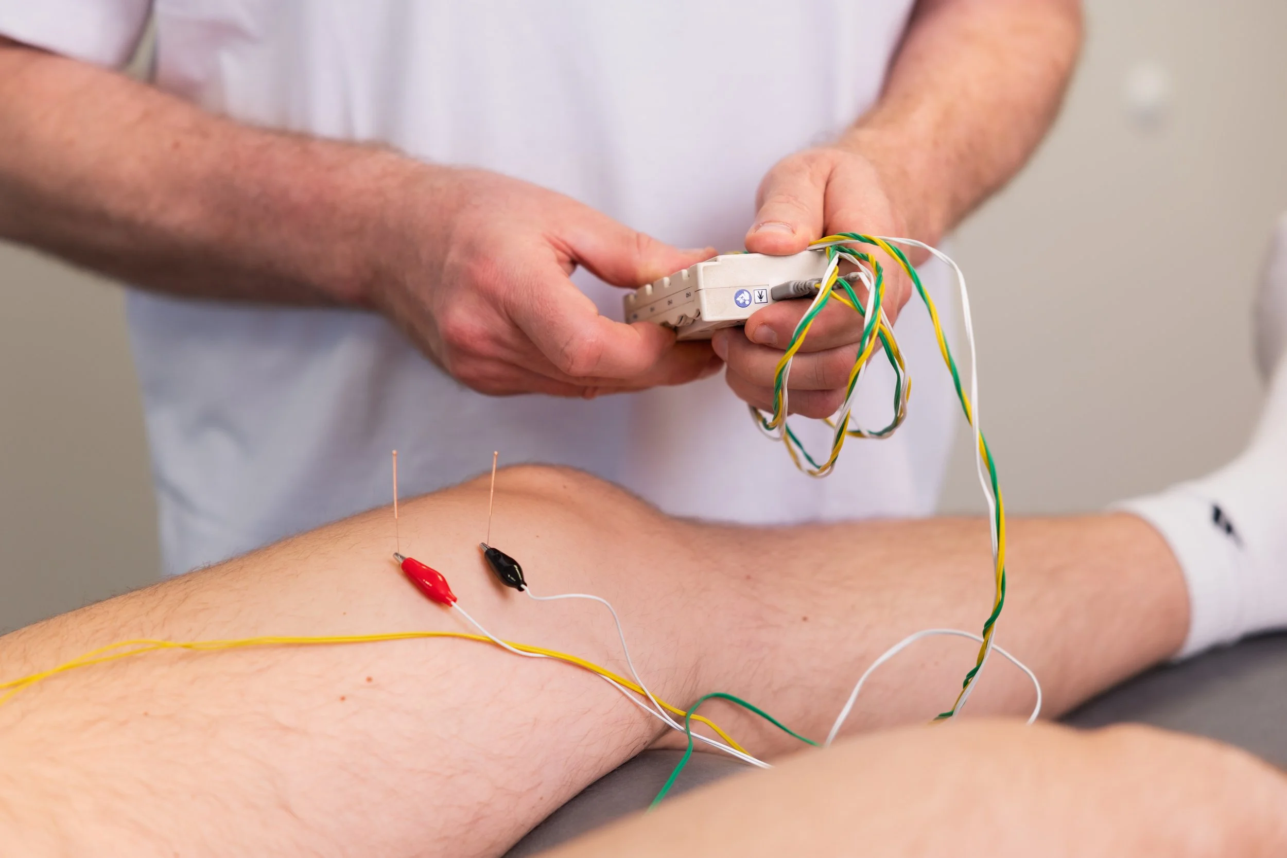 Fysioterapeut bruker elektrisk stimuleringsapparat med nåler og elektroder under funksjonell perifer nervestimulering