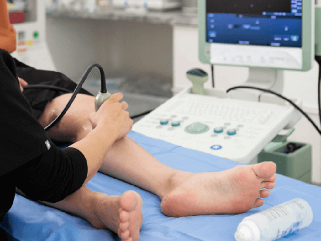 vascular ultrasound test evaluating blood flow in the leg to diagnose circulation problems
