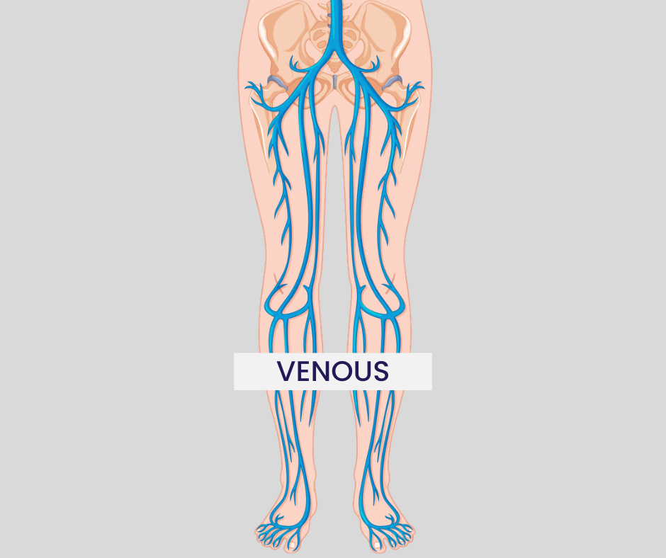 arterial circulation of the legs showing blood flow through lower extremity arteries