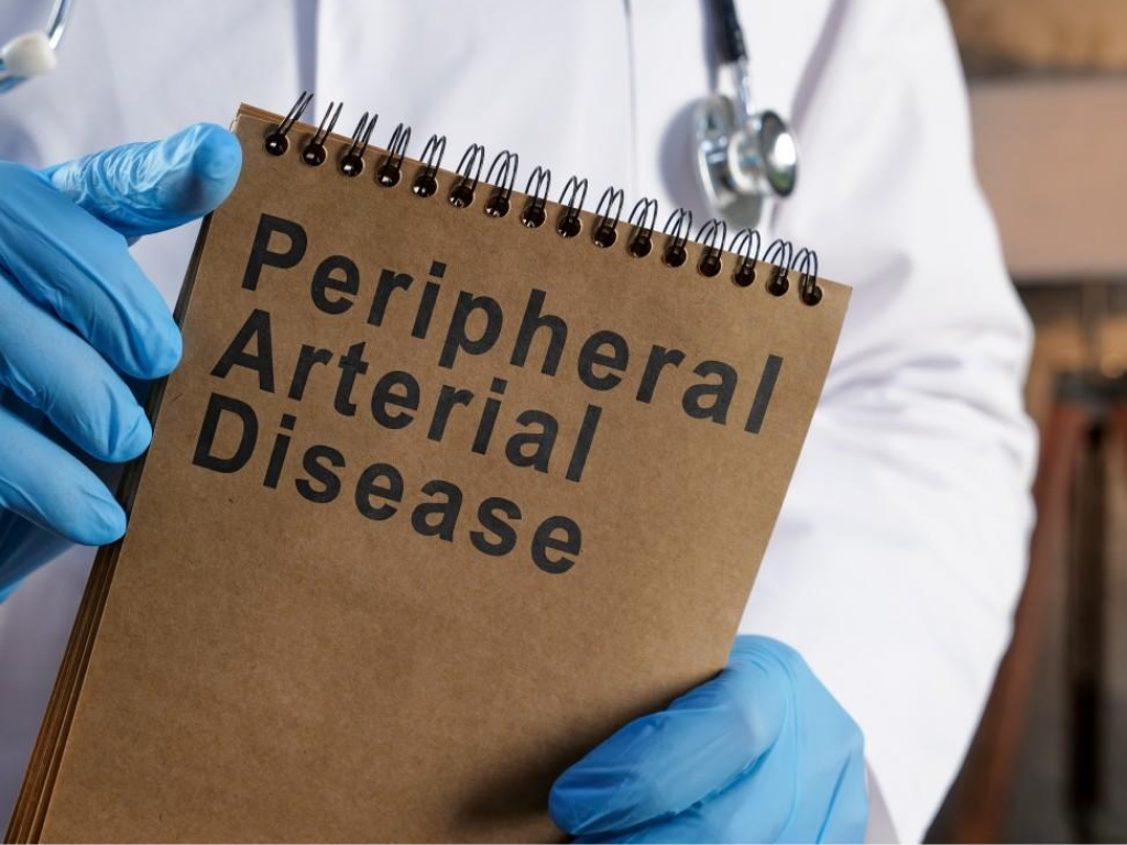 doctor holding notebook labeled peripheral artery disease representing PAD diagnosis and circulation problems