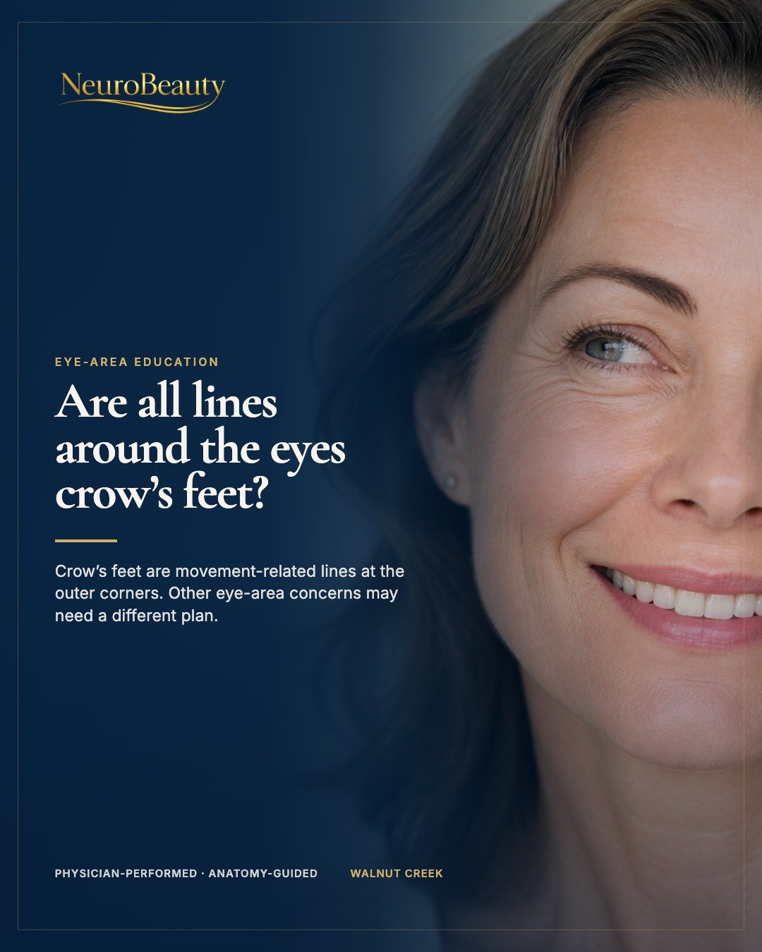 Crow's feet usually describe the movement-related lines at the outer corners of the eyes. Under-eye texture, pigmentation, laxity, and hollows are different concerns and may need a different plan.

Dr. Negar Sodeifi evaluates smile pattern, eye shape