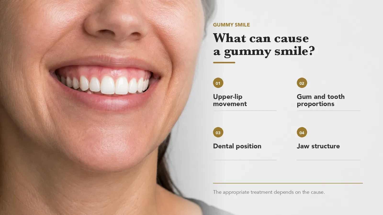 Infographic showing upper lip movement, gum and tooth proportions, dental position, and jaw structure as possible causes of a gummy smile