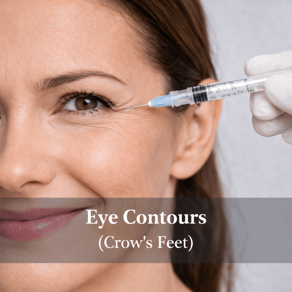 Eye Contours (Crow’s Feet)