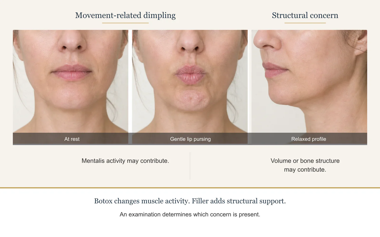 Infographic comparing muscle-related chin dimpling with structural chin concerns