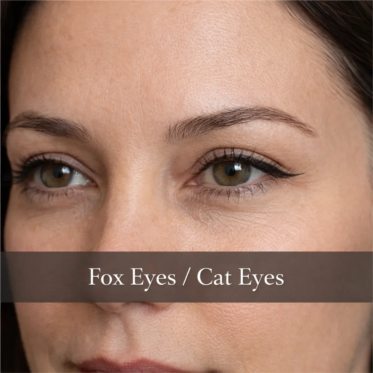 Fox Eyes / Cat Eyes (Lateral Brow Lift)