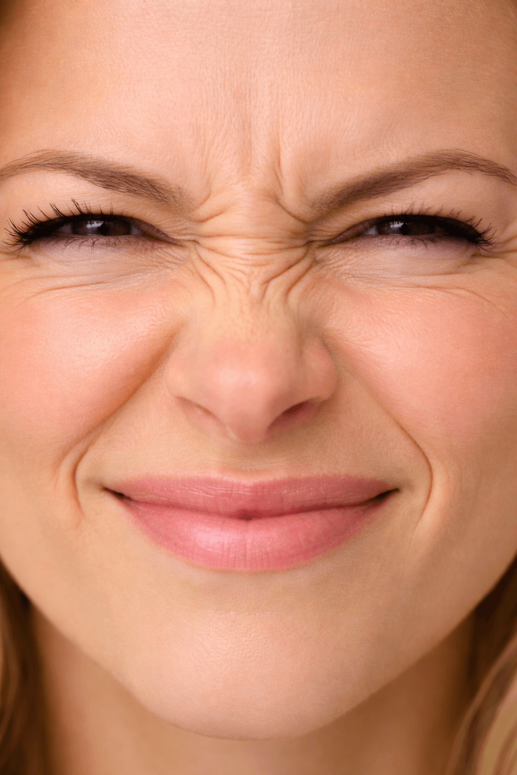 Bunny Lines (Nose Wrinkles)