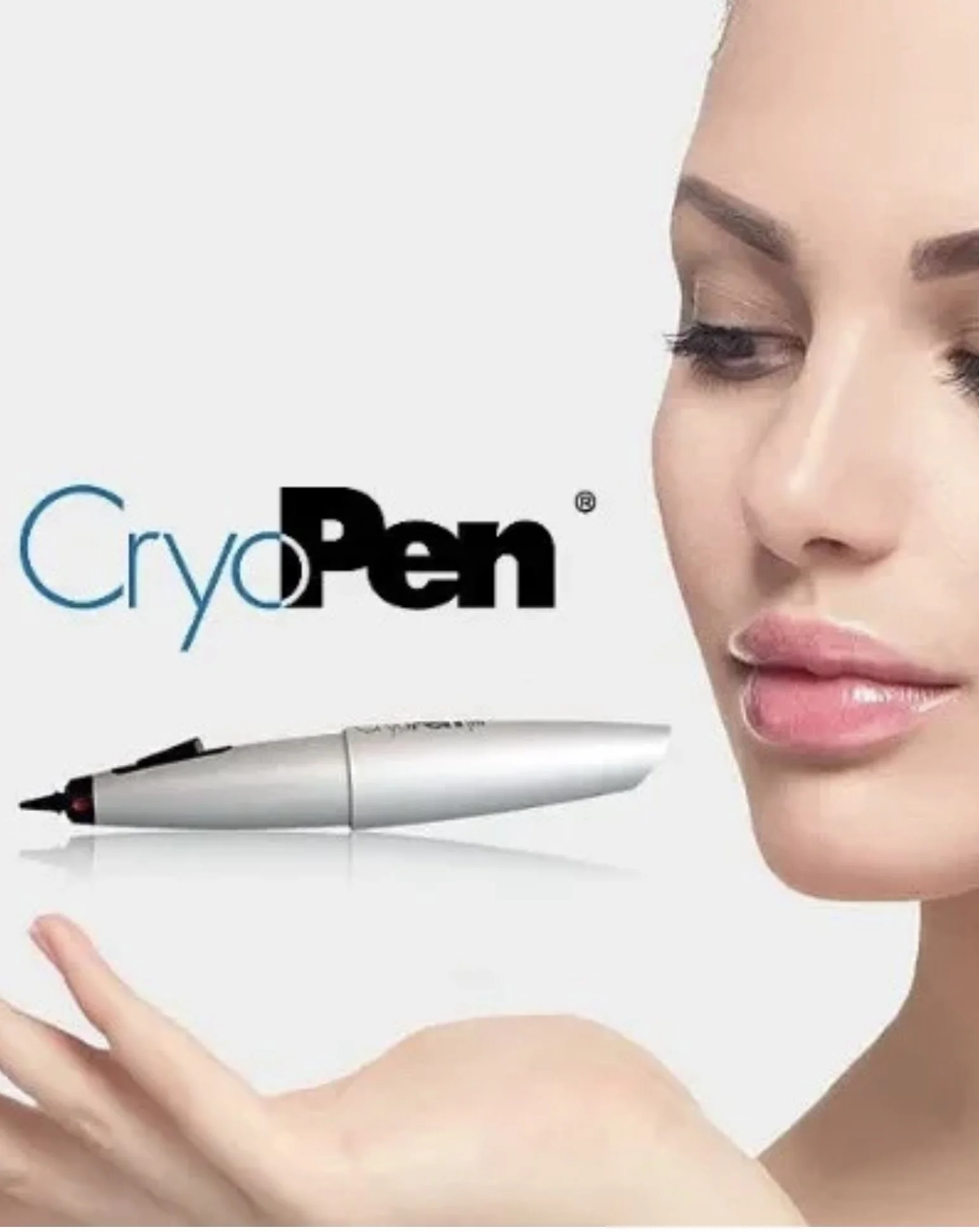 CryoPen Wart & Skin Tag Removal Gainsborough