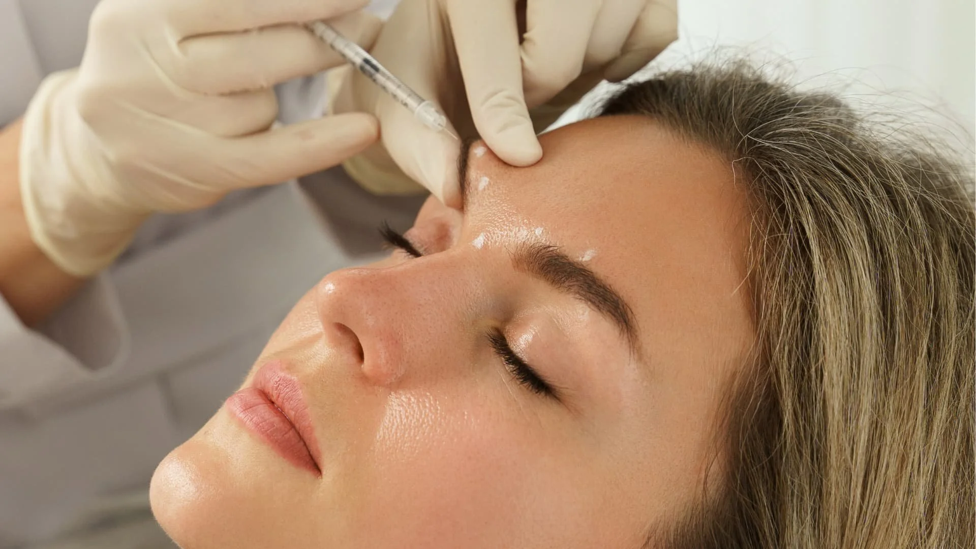 A woman receiving a cosmetic injection in her forehead from a healthcare professional wearing gloves.