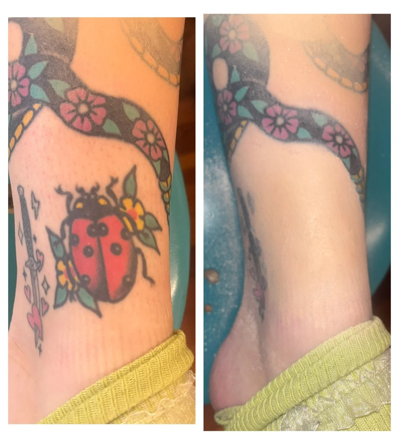 Tattoo Coverage on @salty_stellfish