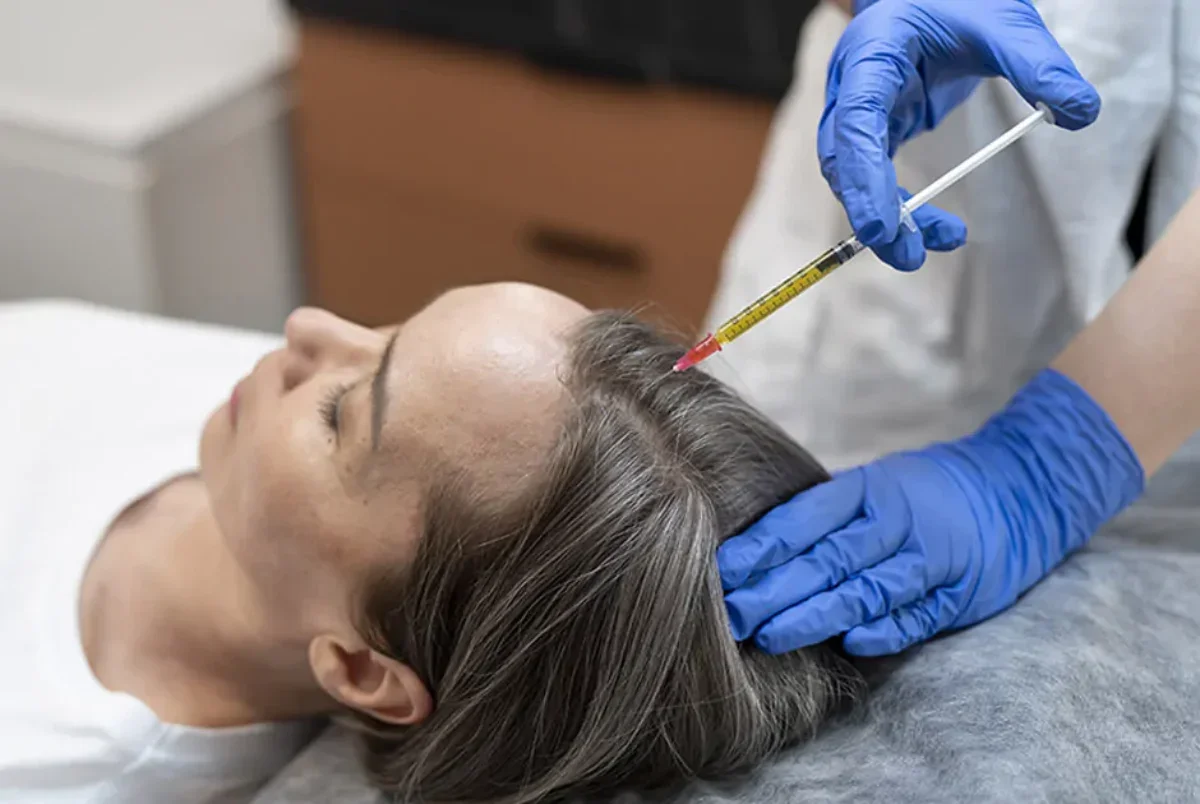 prp-for-hair-restoration-gallery-1-1200x804[1].webp