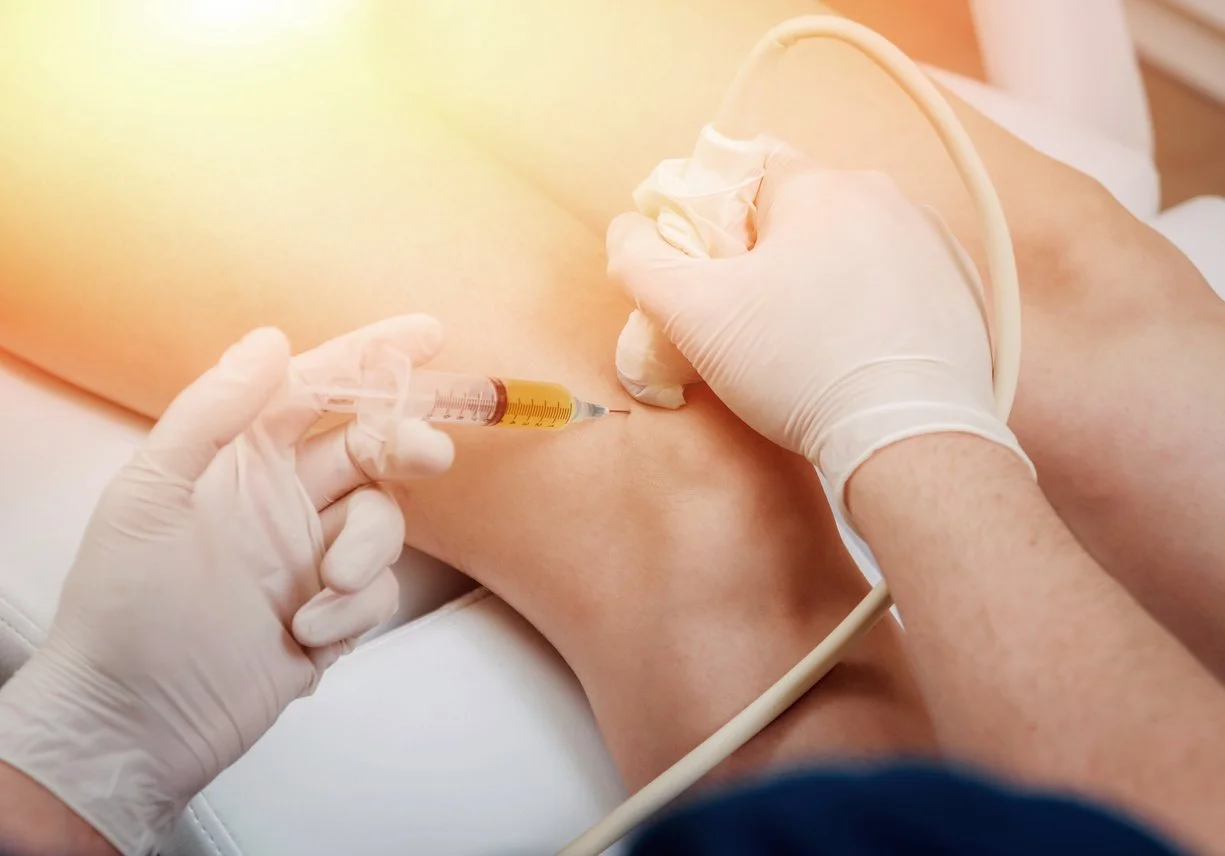 Ultrasound guided PRP injection into knee