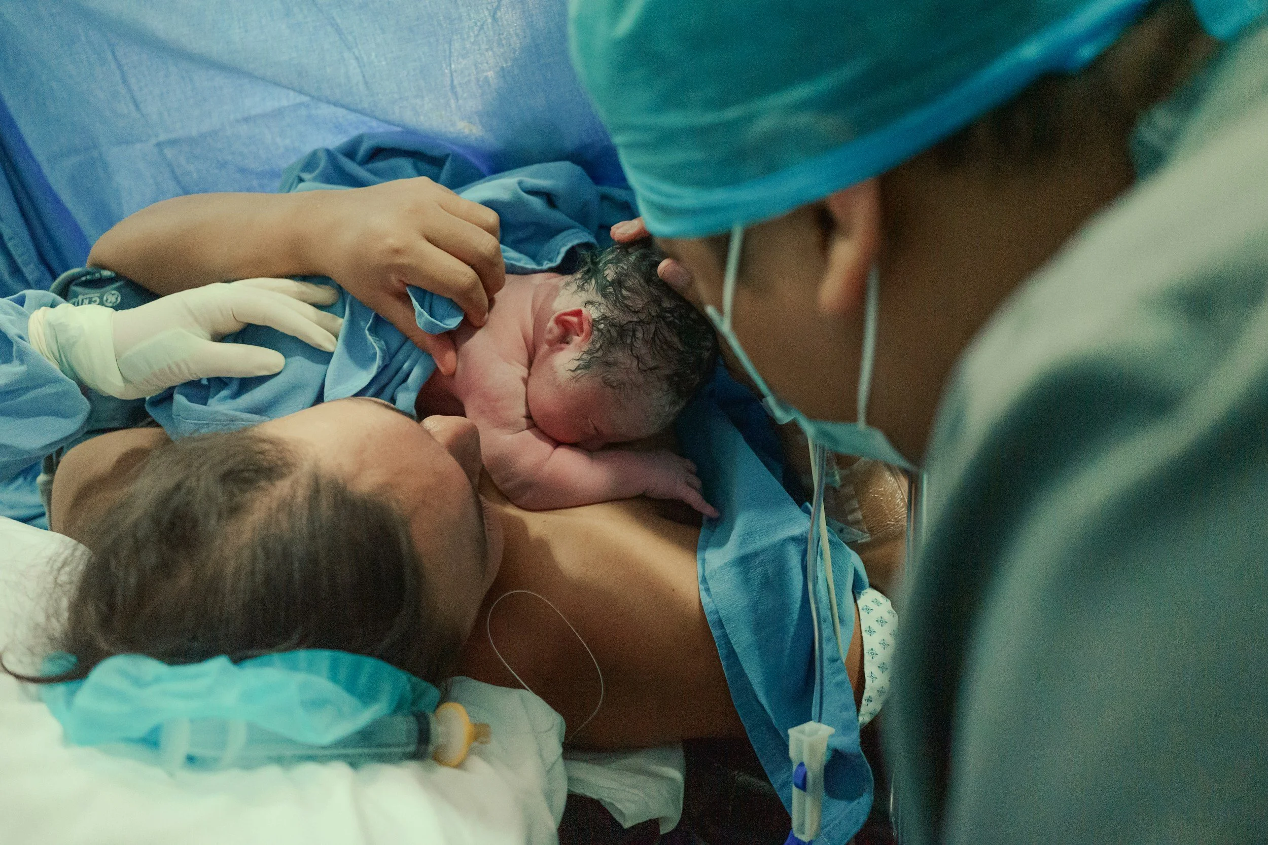 Perinatal mental health counselling image of woman holding her newborn on a surgical table in a hospital operating room after delivery, with a person wearing a medical mask standing beside her.
