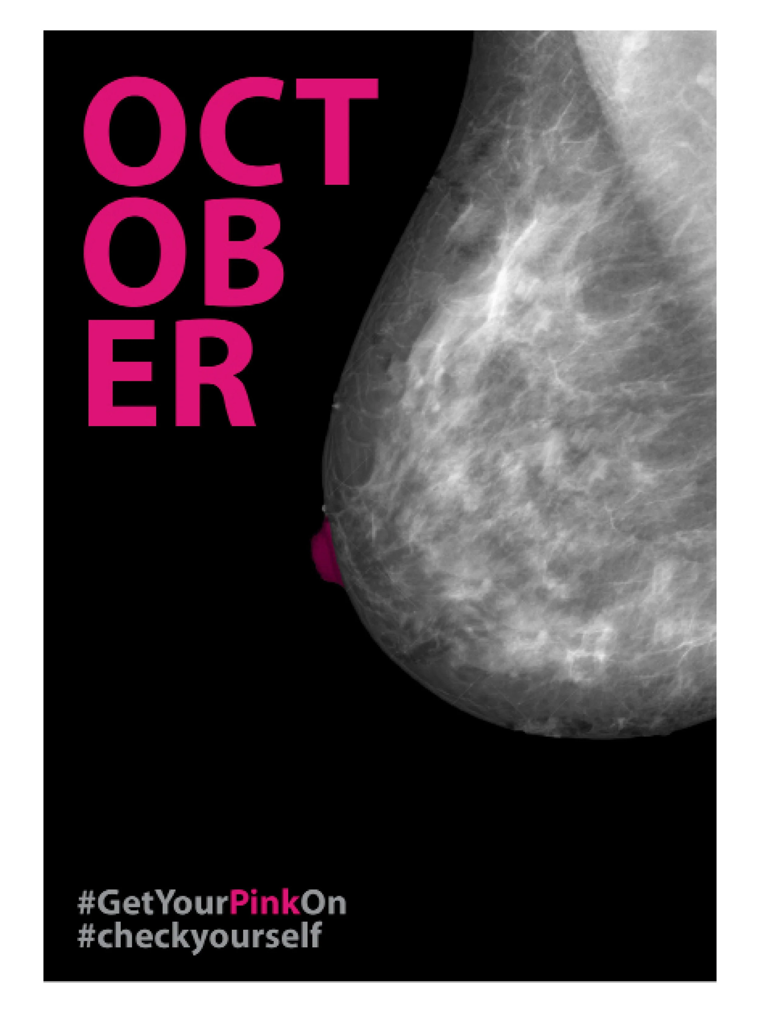 Breast cancer awareness poster with an X-ray image of a breast and pink text reading 'OCTOBER'. The hashtags '#GetYourPinkOn' and '#checkyourself' are at the bottom.