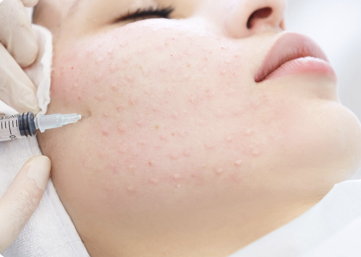 Mesoterapia Facial Revitalizante Premium