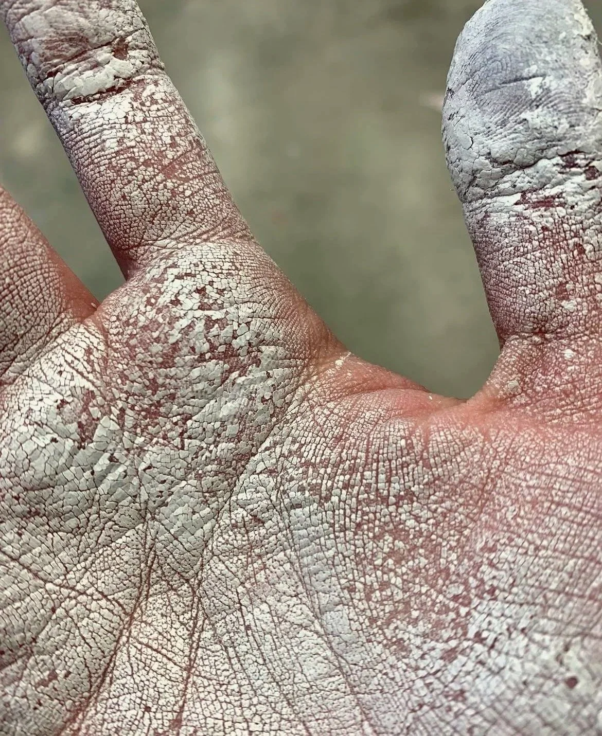 Close-up of a person's hand covered in white, cracked, dry paint or powder, with the hand slightly curved.