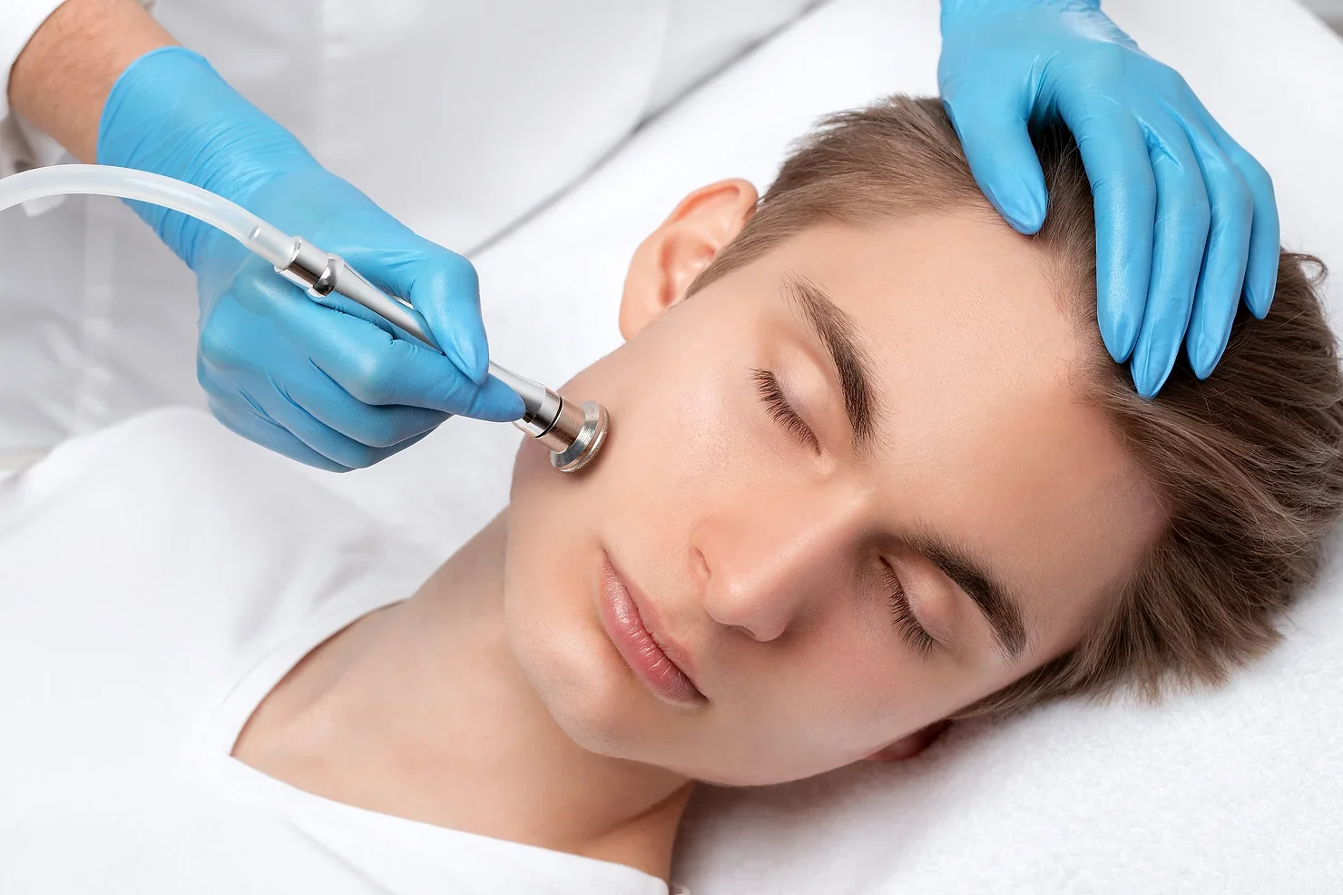 Microdermabrasion