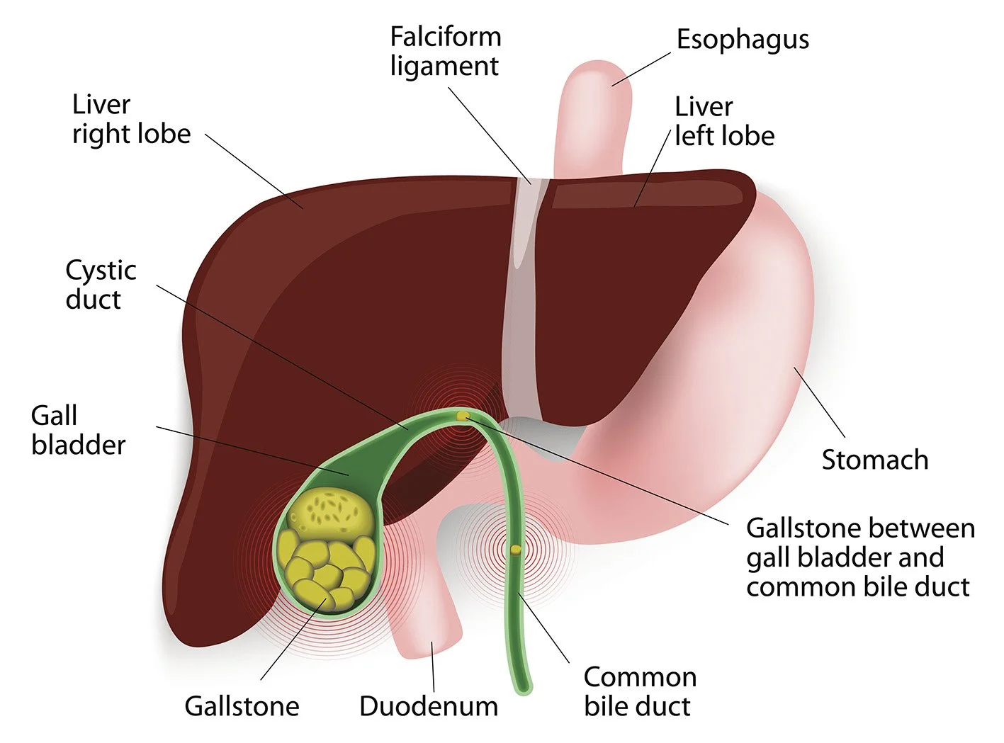 Dr Patrick Lau Canberra General Surgery Gallbladder Surgery