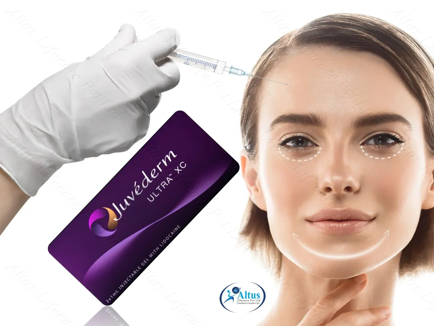 Juvederm