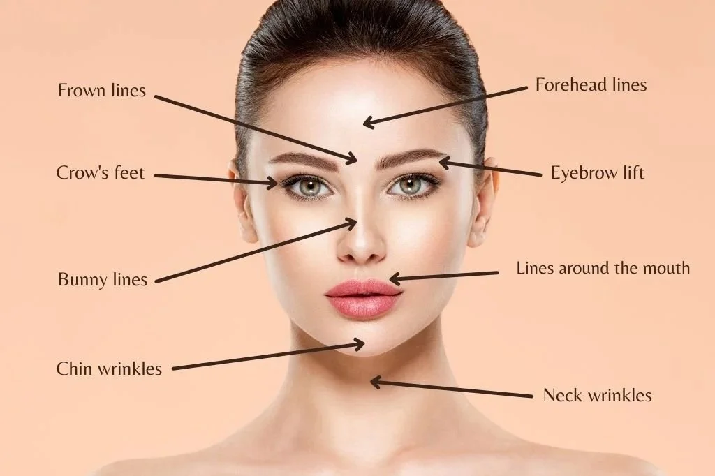 common-botox-areas.jpg