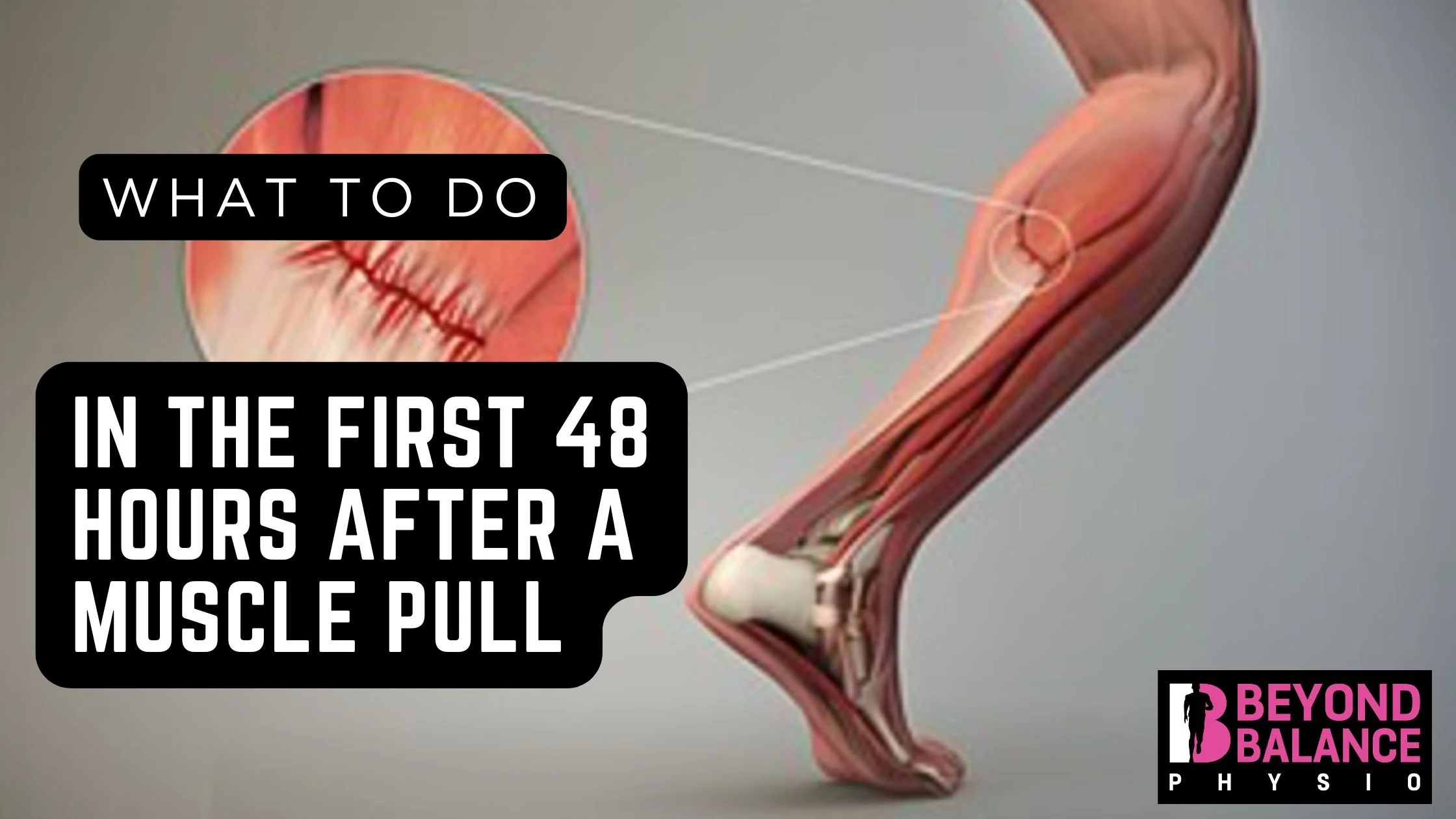 What to Do in the First 48 Hours After a Muscle Pull