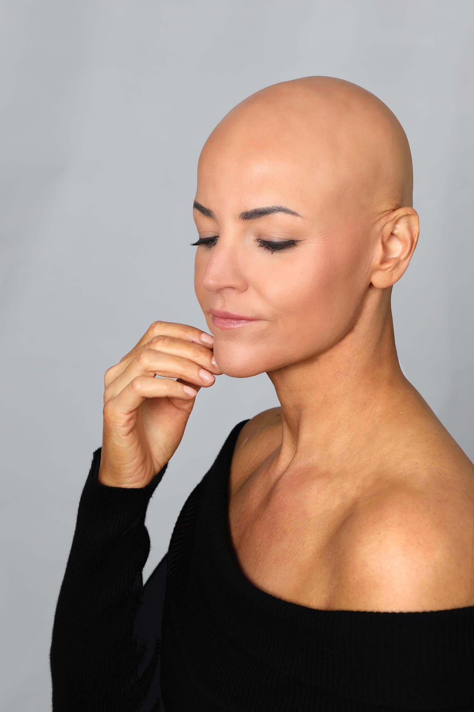 hair loss in women