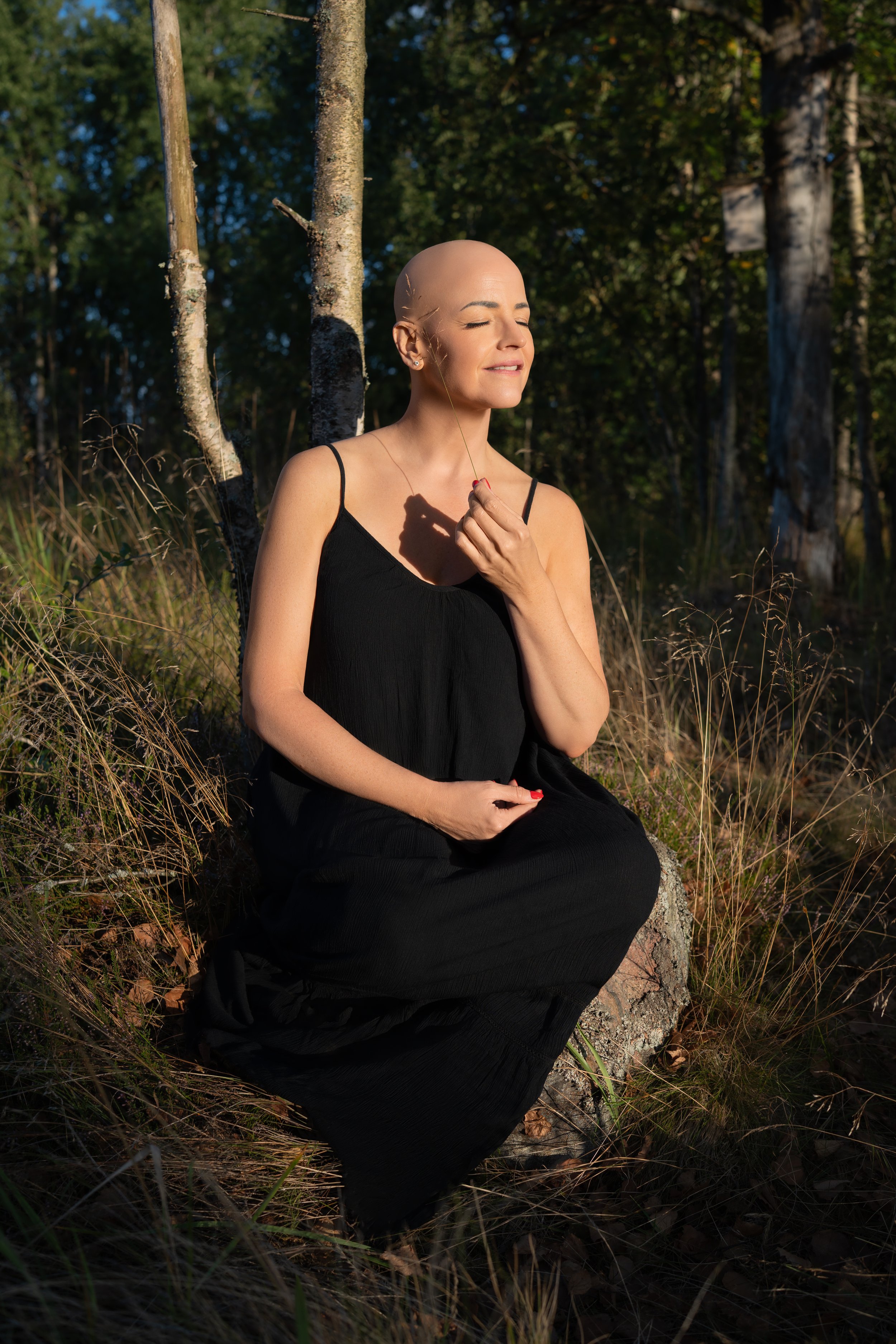 Alopecia on woman