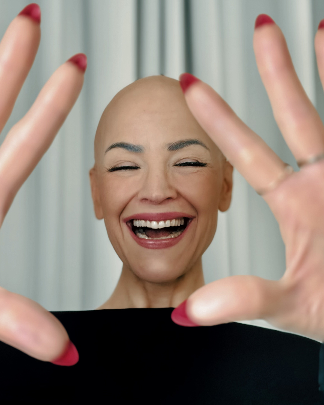 Hair loss on women