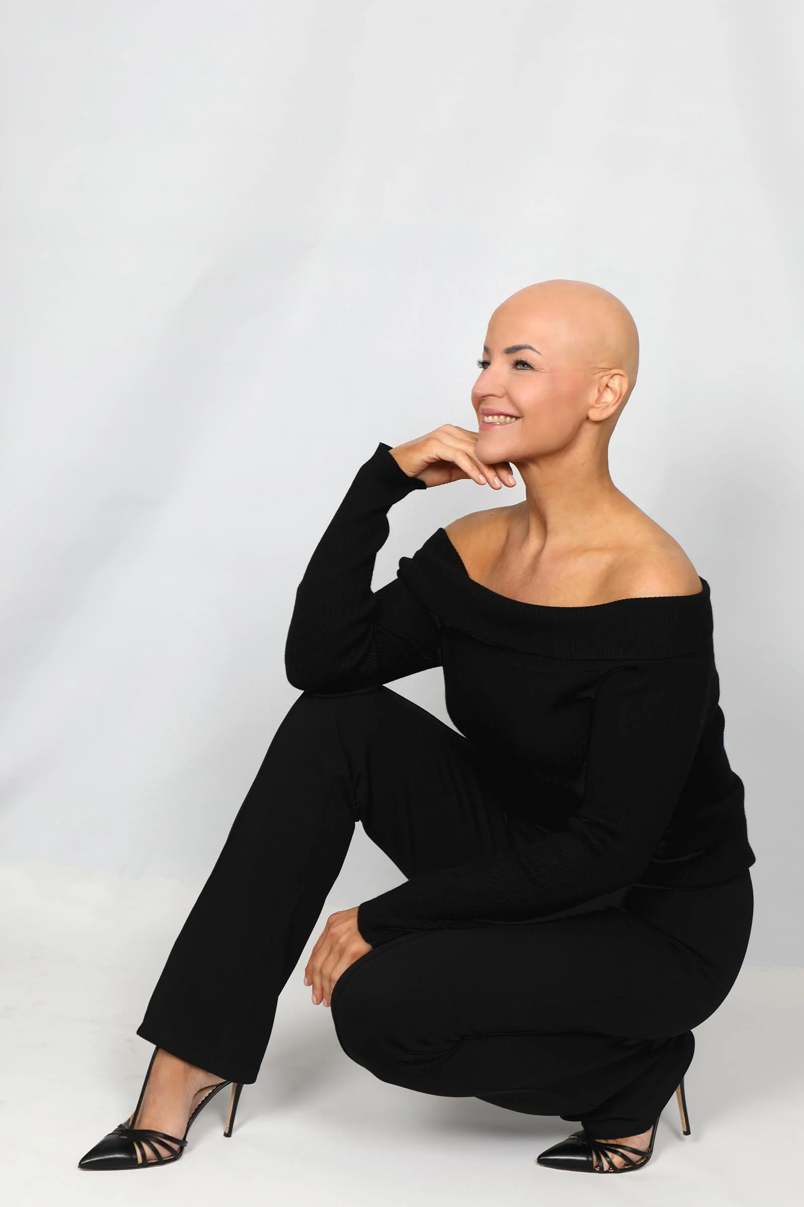 Alopecia areata hair loss​