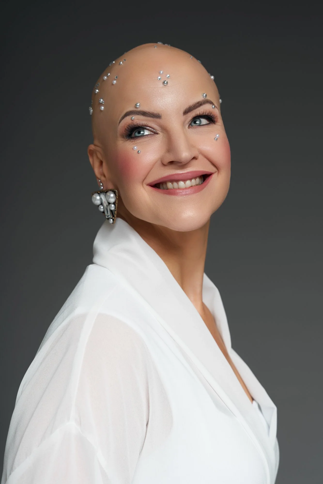 Alopecia Model