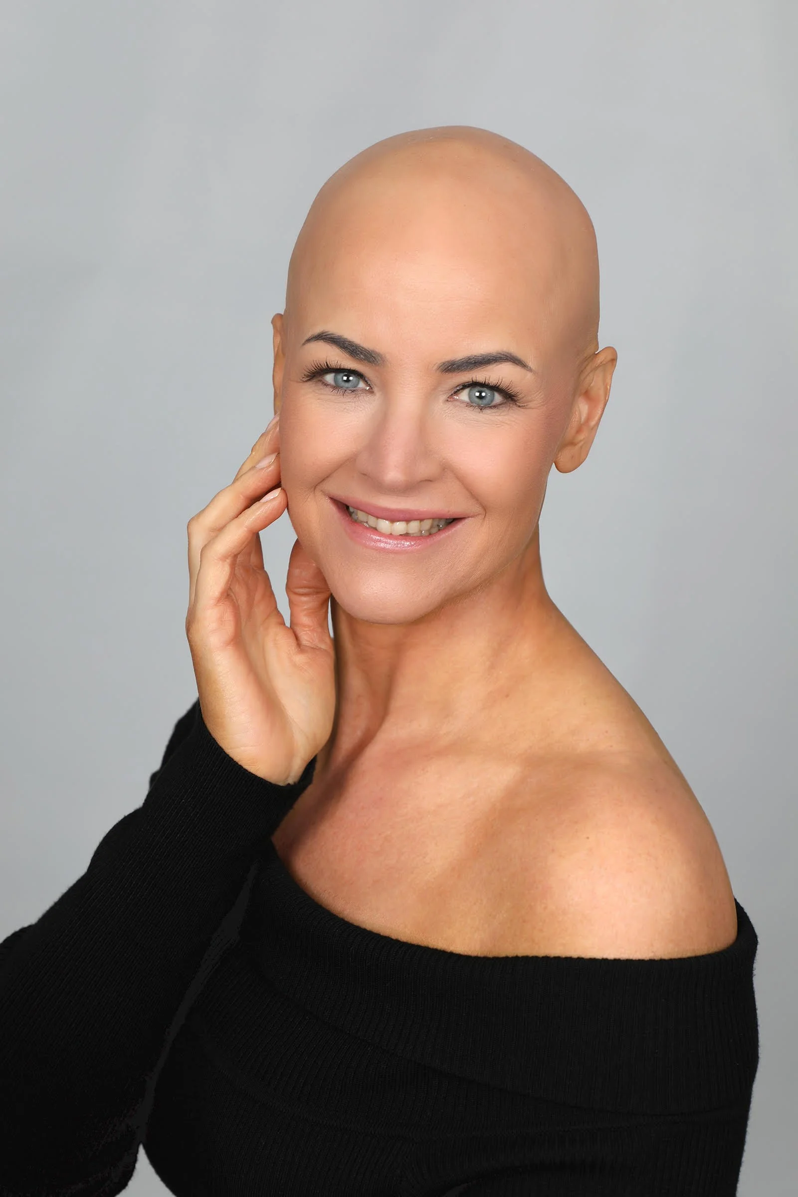 hair loss in women