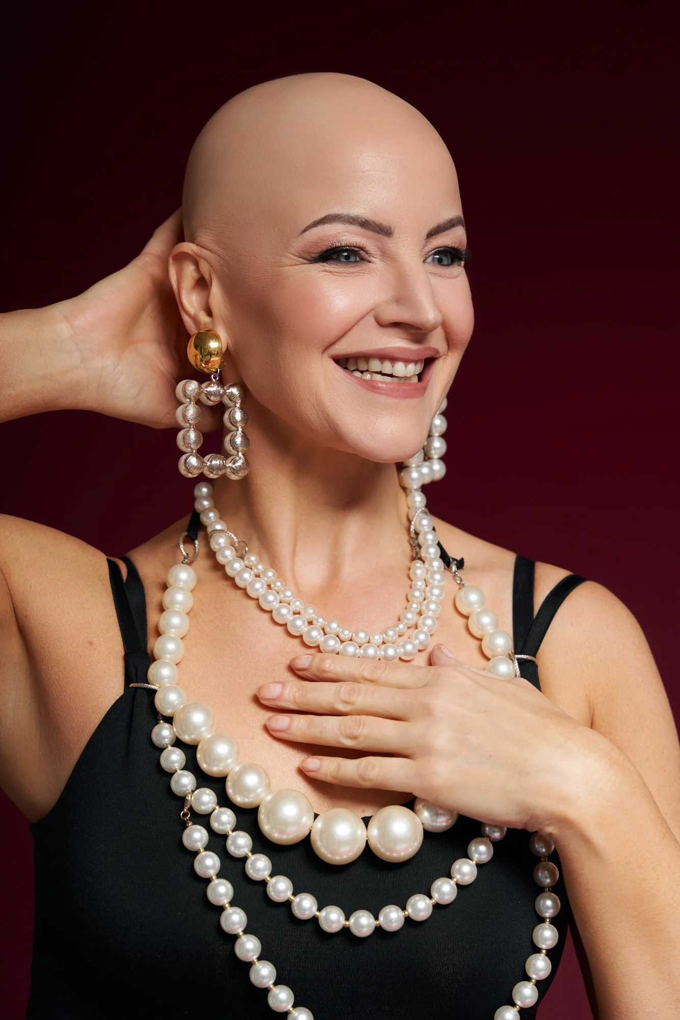 alopecia advocate 