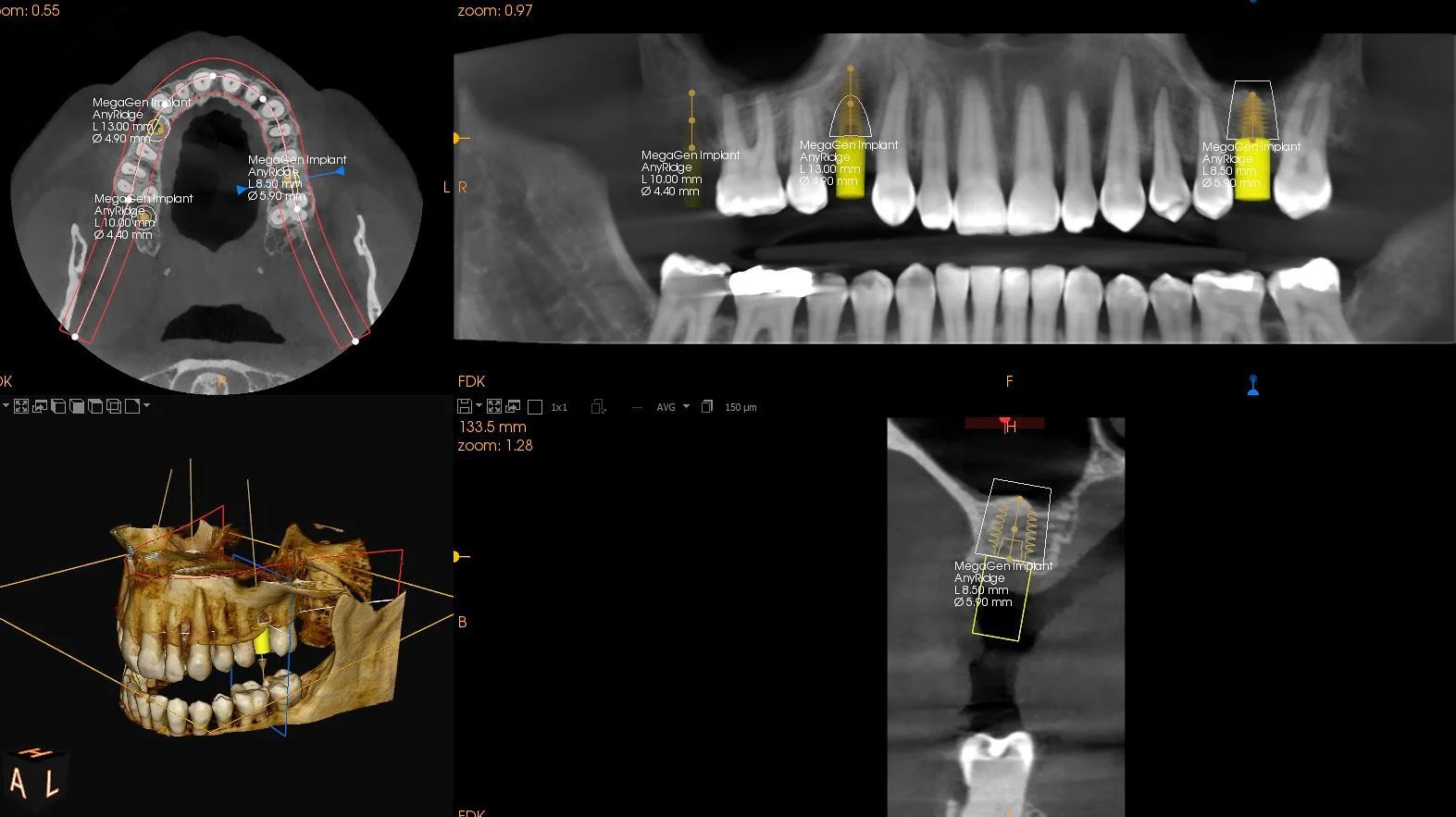 cs-8200-access-4-1.jpg