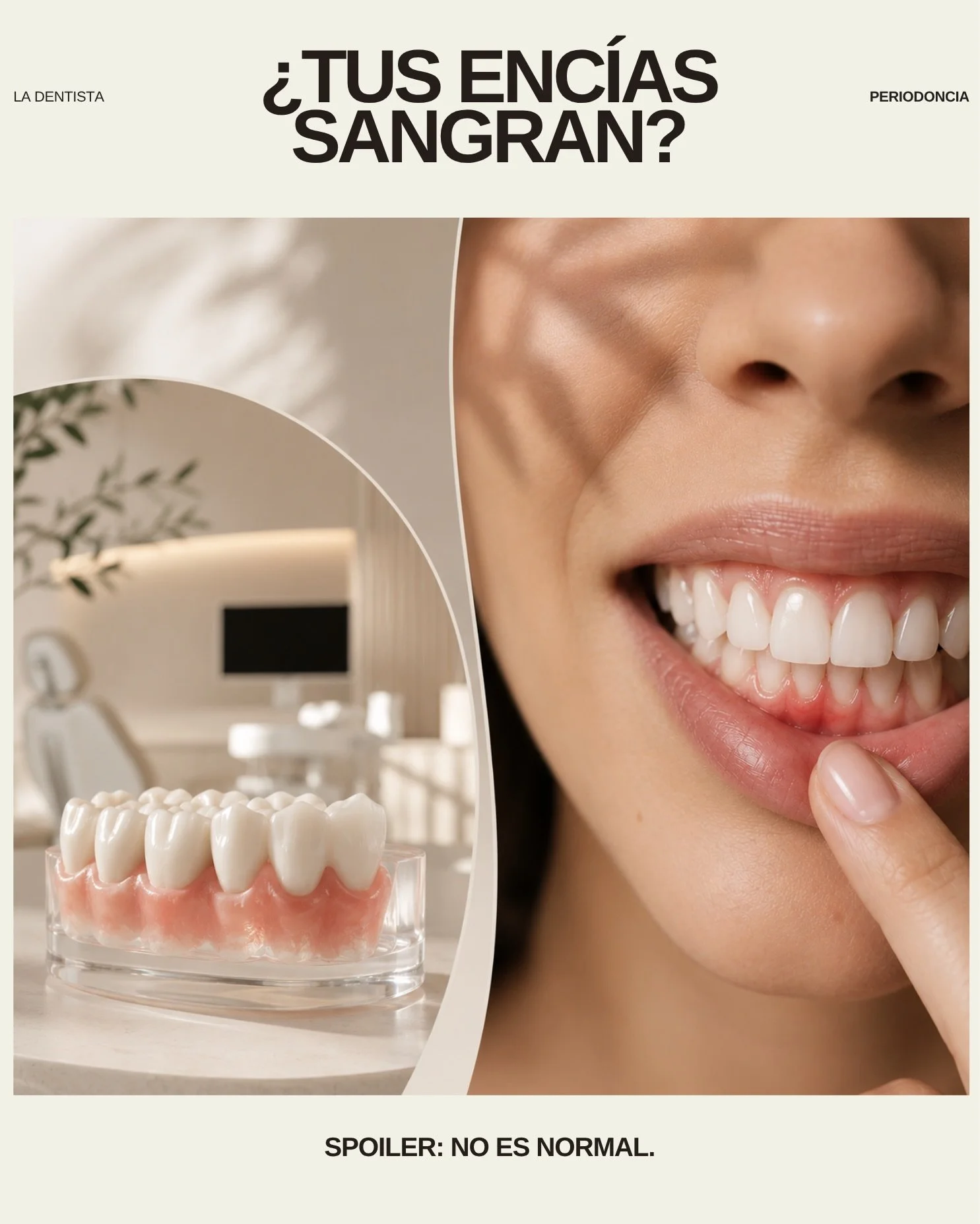 🚨 Spoiler: no es normal.

Si tus enc&iacute;as sangran al cepillarte, puede ser una se&ntilde;al de inflamaci&oacute;n o enfermedad periodontal.

Muchas veces empieza sin dolor&hellip; y cuando molesta, ya es tarde.

En Cl&iacute;nica La Dentista re