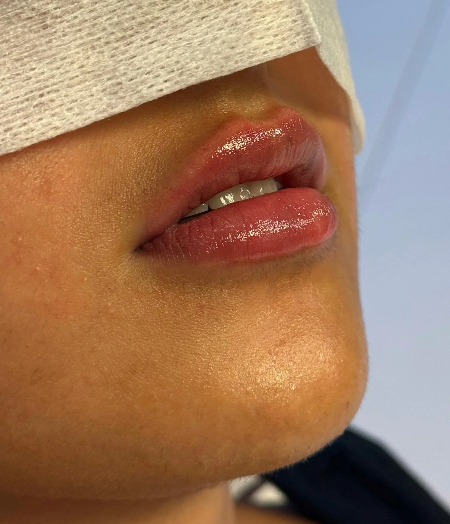 Nærbilde av en persons lepper og del av ansiktet, der personens ansikt er delvis dekket av en beige t-skjorte eller genser.