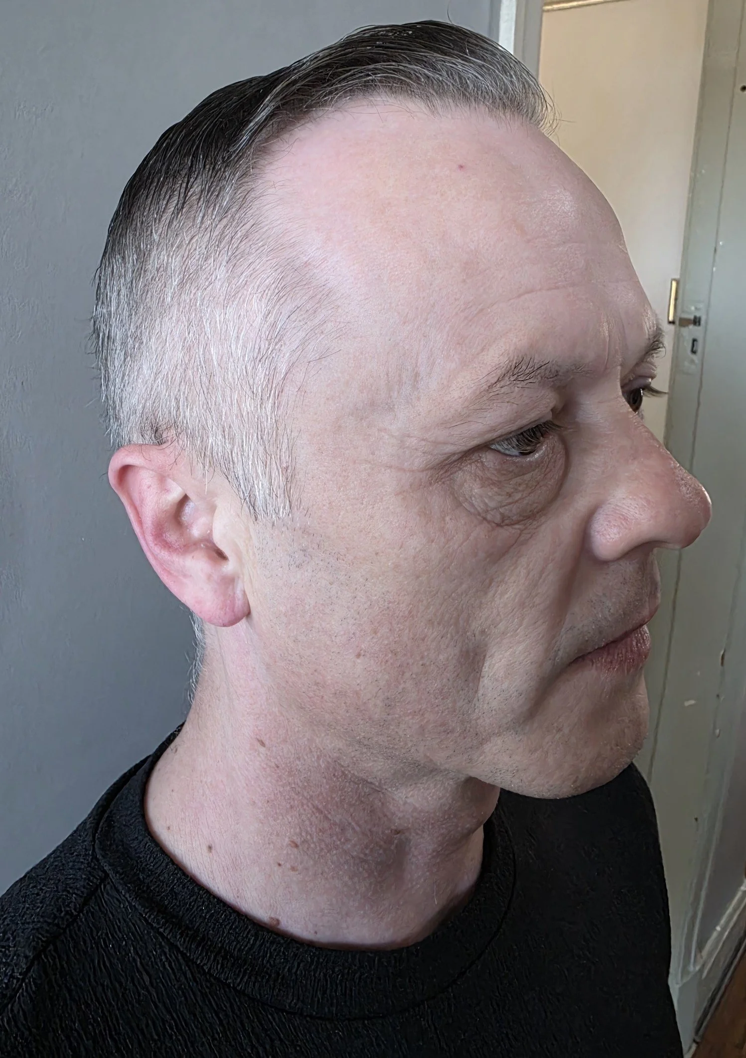 CW 14 weeks post treatment.