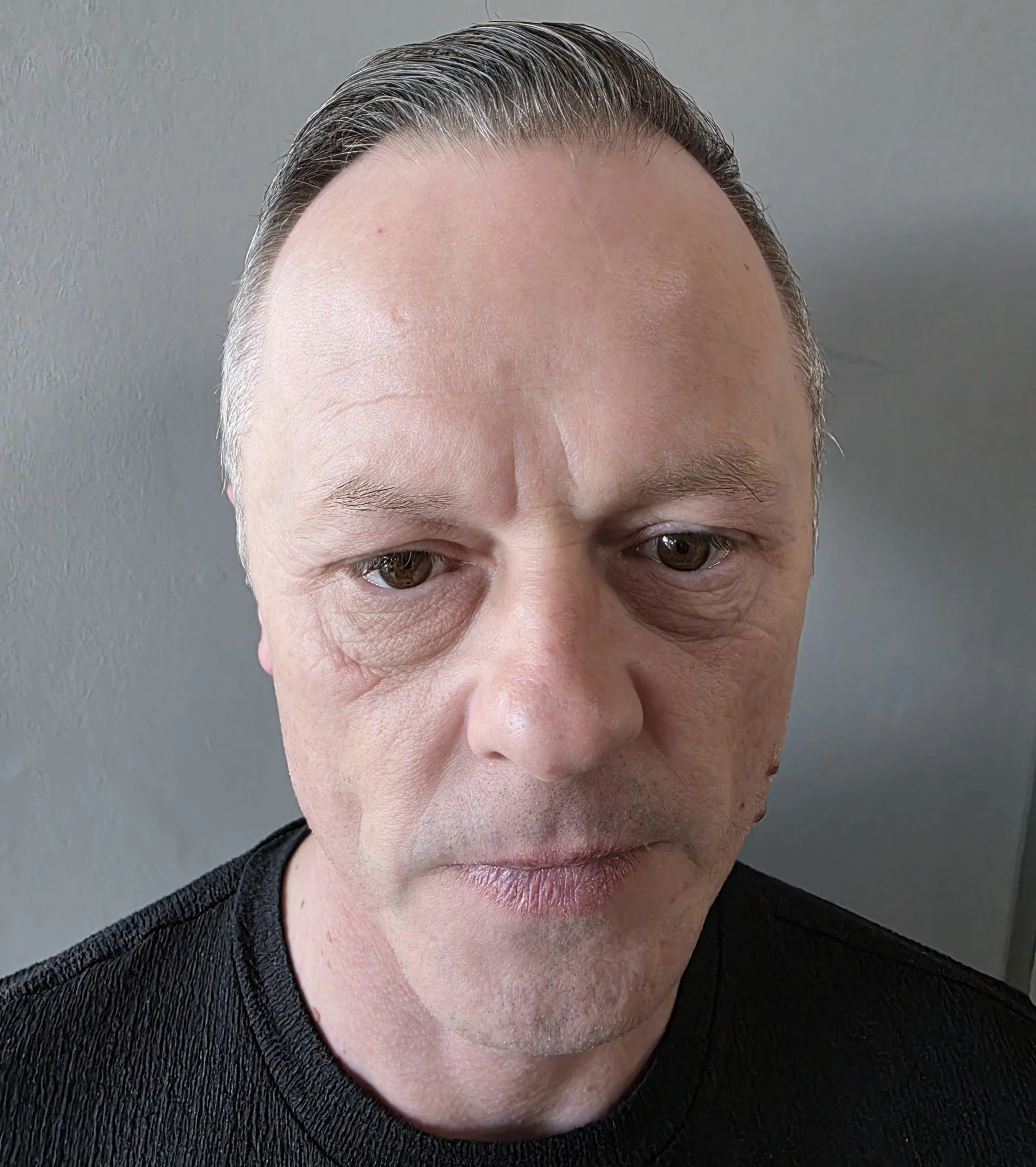 CW 14 weeks post treatment.