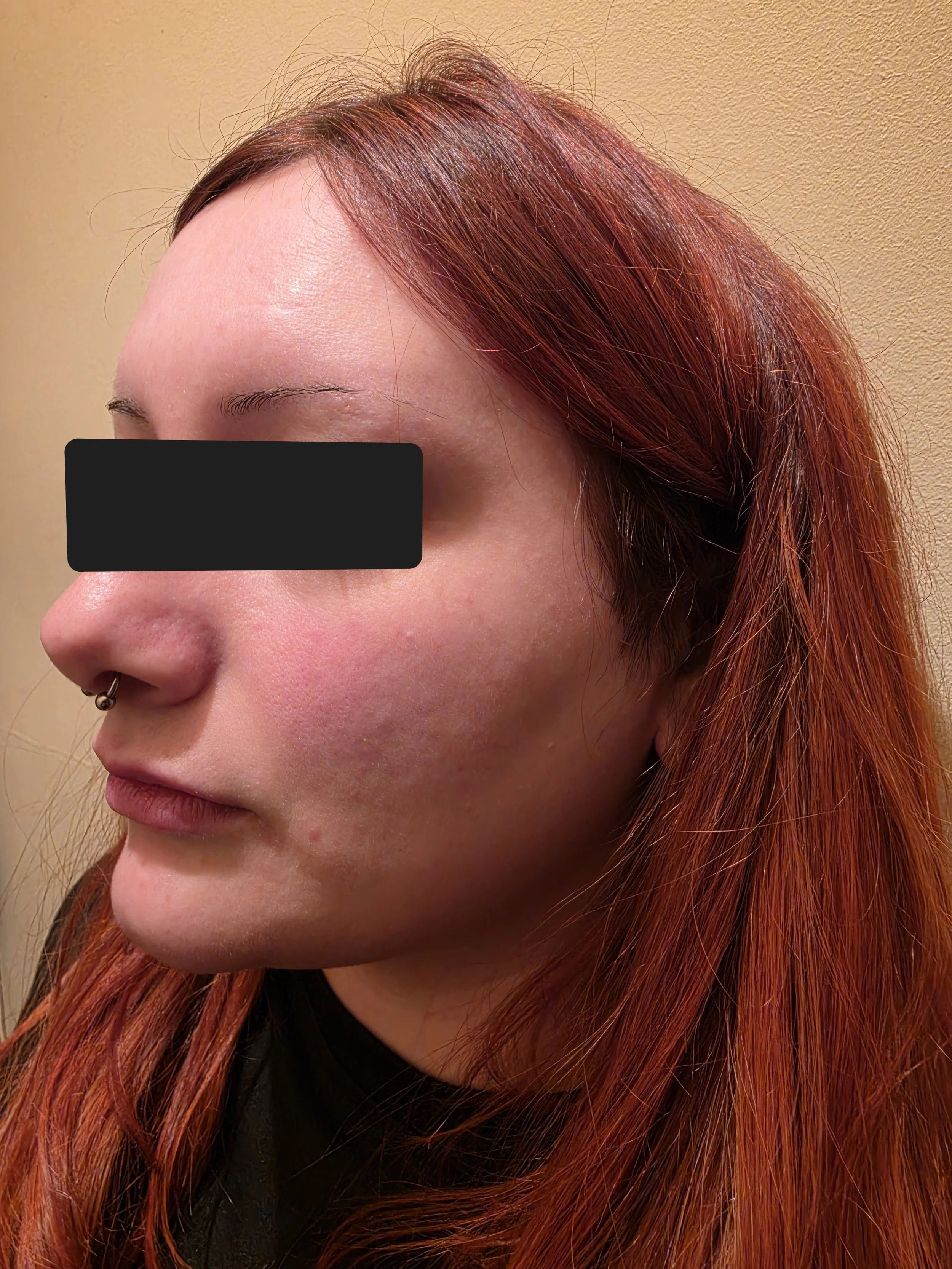 NB after treatment