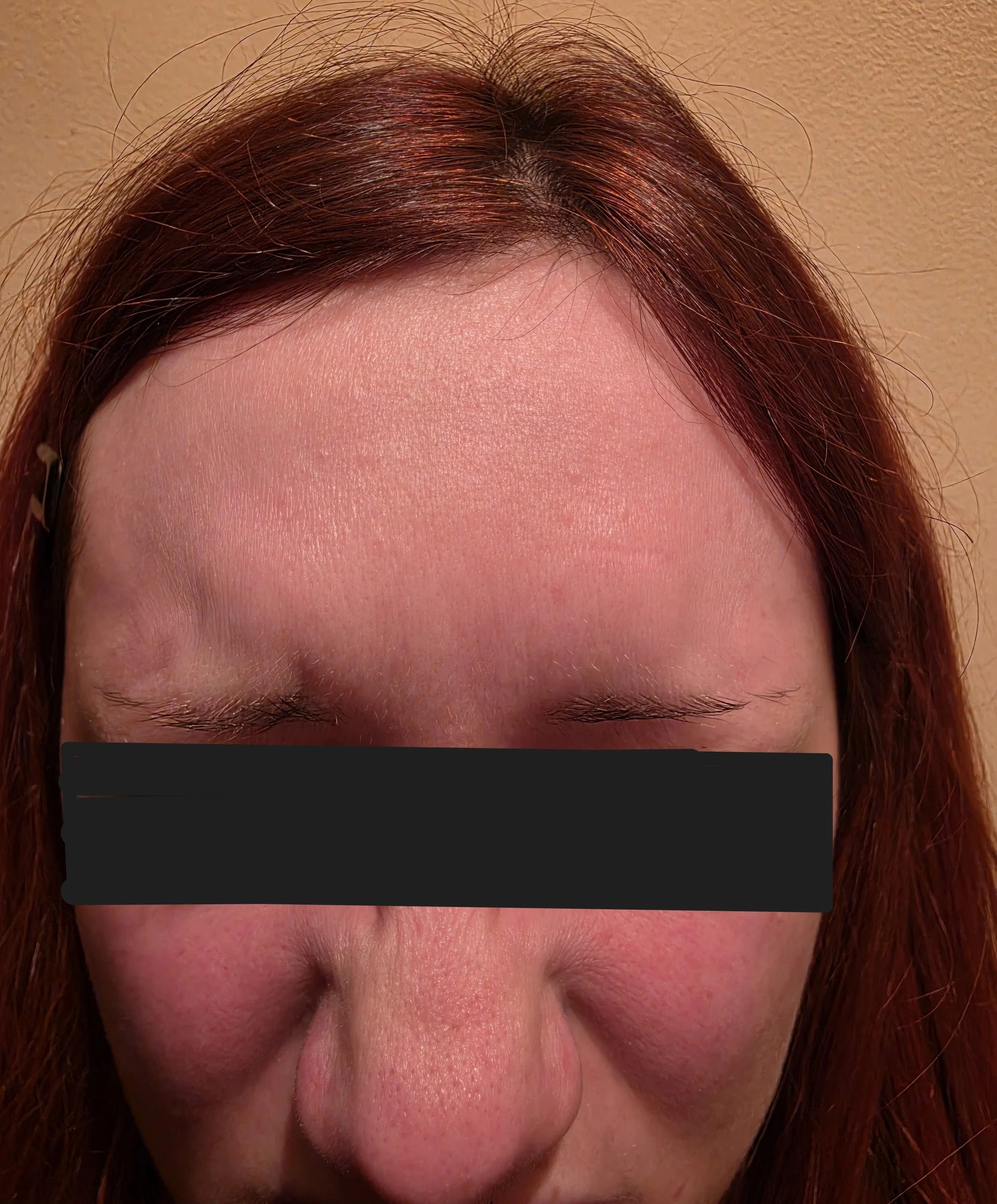 NB after treatment