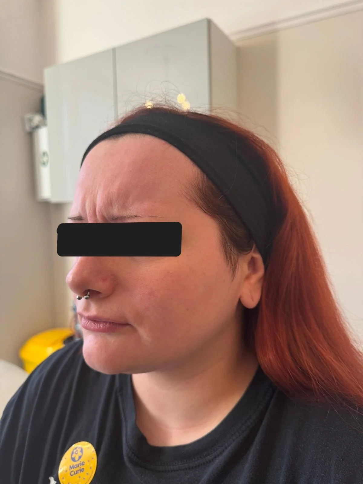 NB Before treatment