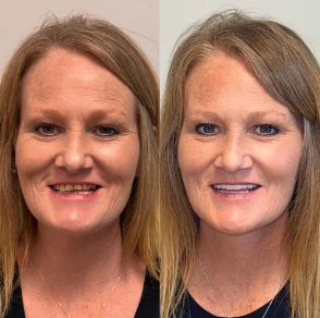 Side-by-side comparison of a woman with reddish hair before and after a makeover.
