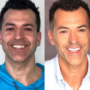 Side-by-side portraits of a man with dark hair, smiling in casual and professional settings.