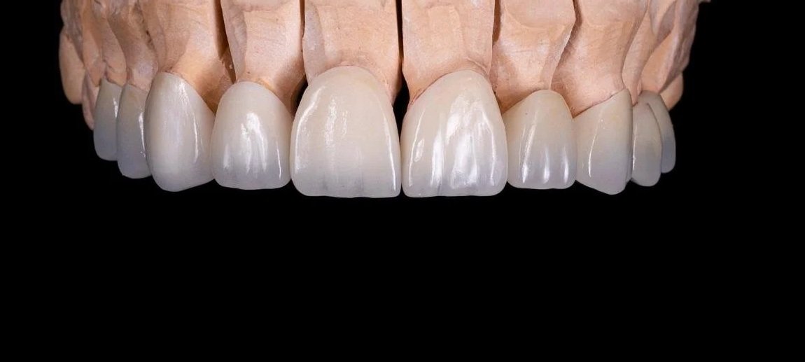 Byrne Dental