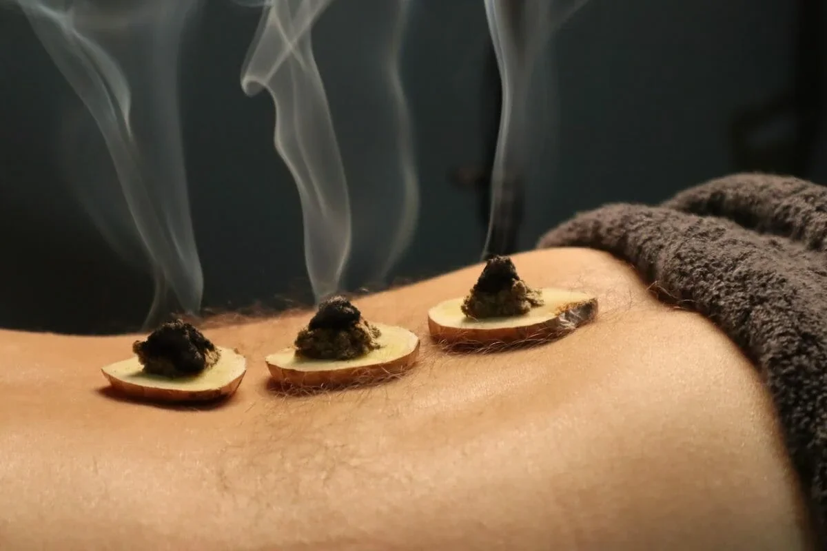 Close-up of a person receiving a herbal or cupping therapy with small herbal balls placed on their back, and steam rising from the therapy.